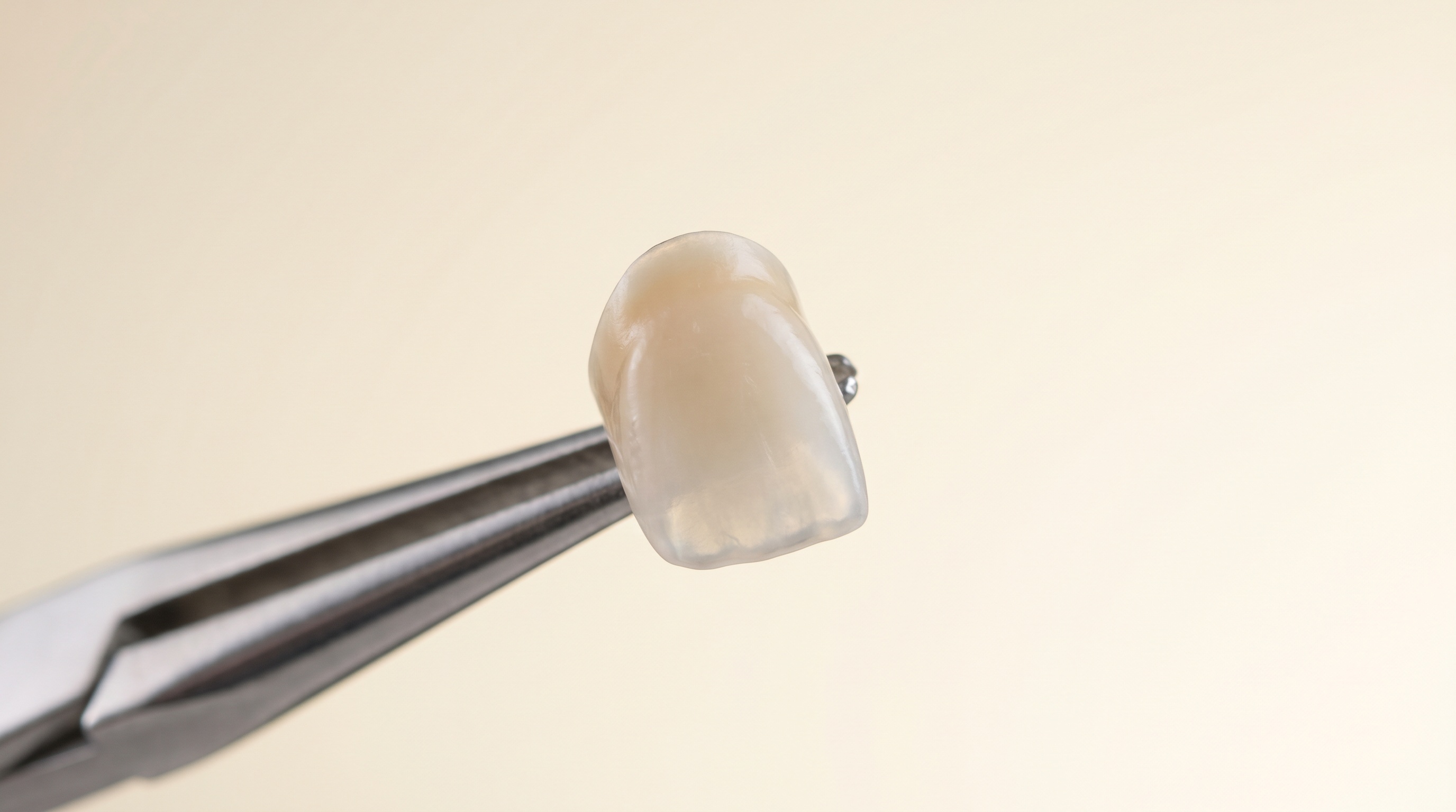 Adhesive Ceramic Restorations