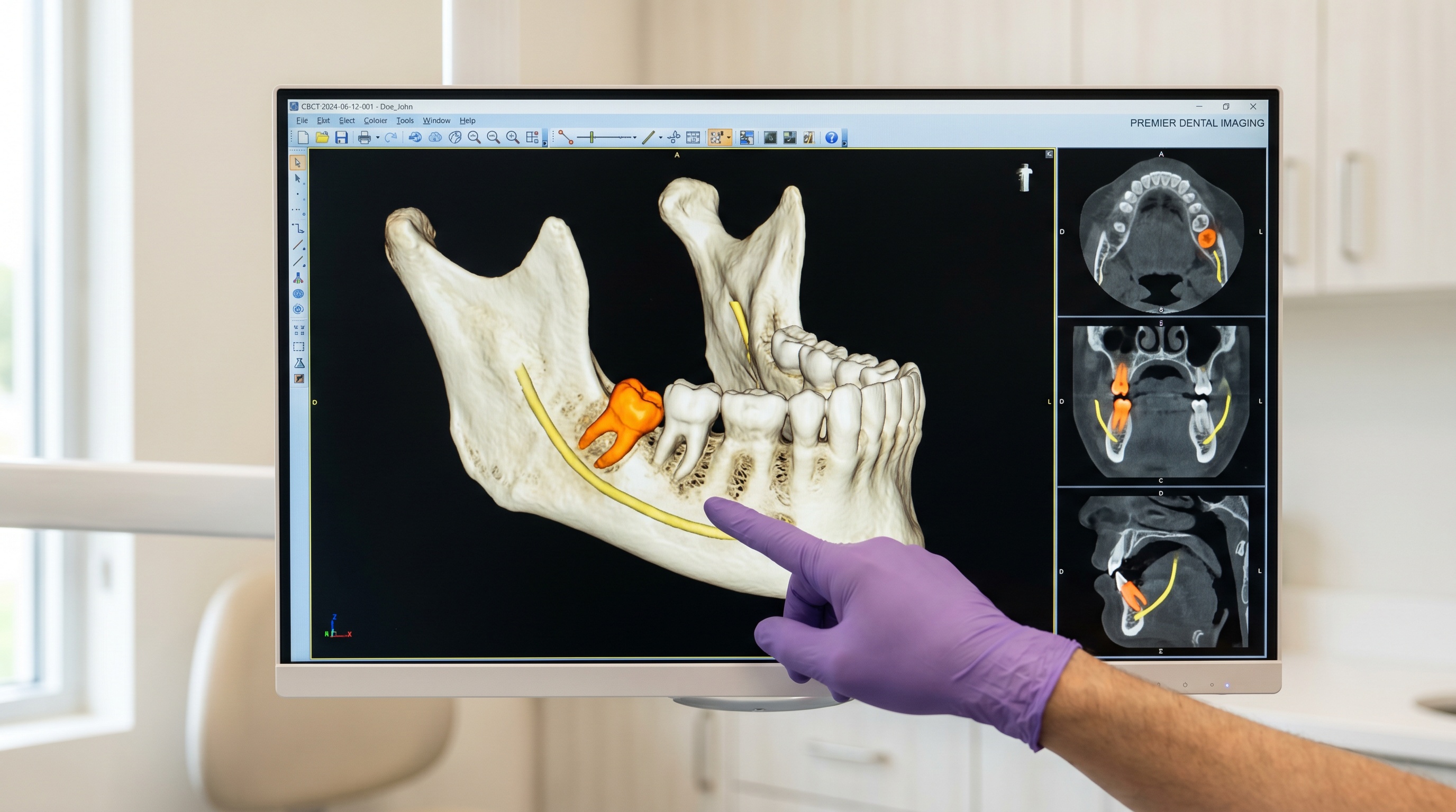 Retained Tooth Surgery