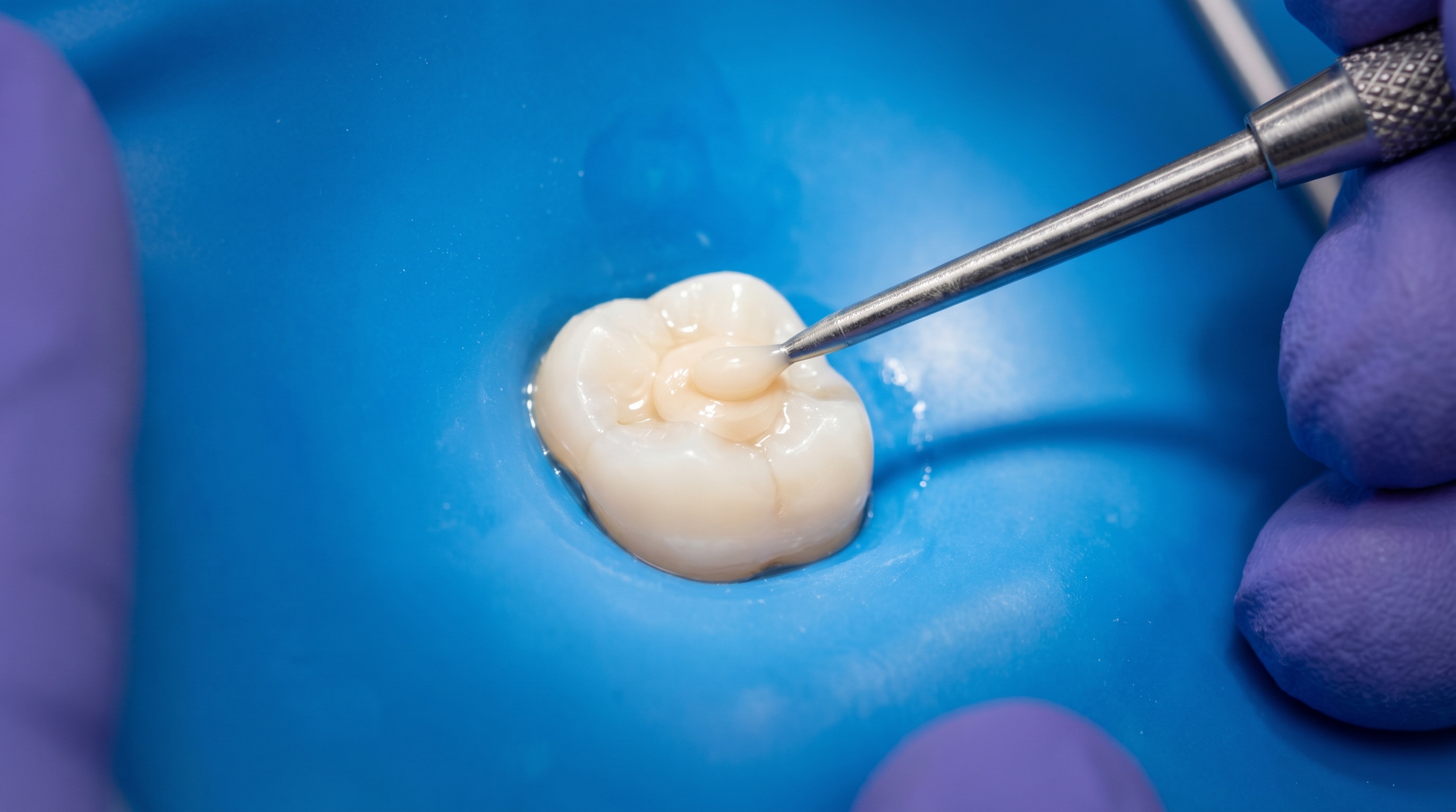 Composite Resin Restorations
